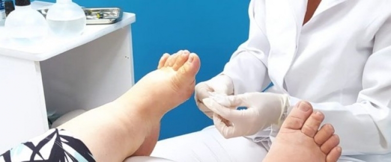 Curso de Podologia na Unesc Ararangu� refor�a atendimentos ao p�blico