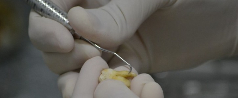 Banco de Dentes Humanos da Unesc auxilia nos estudos de acadmicos de Odontologia