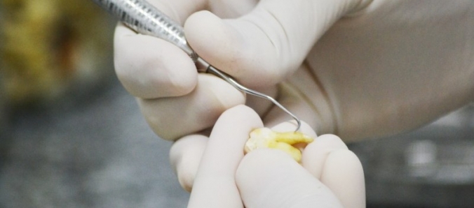 Banco de dentes: Projeto da Unesc auxilia no avano da rea odontolgica