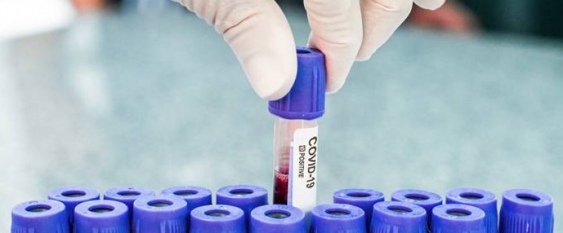 Brasil pode estar pr�ximo do pico da pandemia de Covid-19