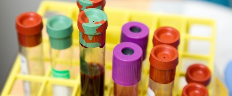 Professor da Unesc avalia os avanos no que diz respeito  pesquisa sobre a Covid-19