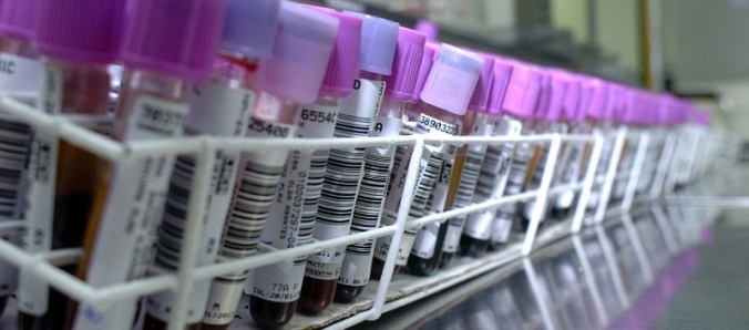 UNESC oferece atendimento gratuito em hematologia adulto e pediatra