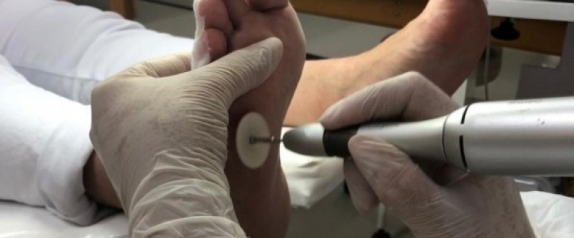 Unesc Tec busca volunt�rios para aulas pr�ticas de Podologia em Ararangu�